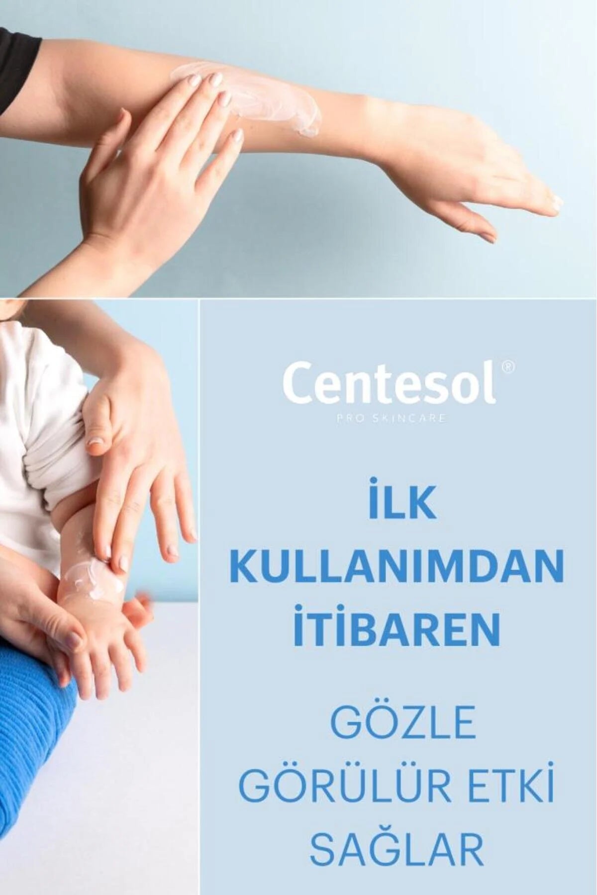 Centesol Recovery Cream 30g | Herstelcrème met Centella Asiatica, Ceramiden & Squalaan voor Gevoelige Huid