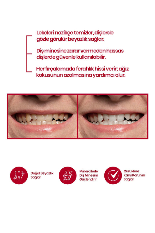 SuperYou Teeth Whitening Powder Rode Koraal Aardbei Tandbleekpoeder - 70 g