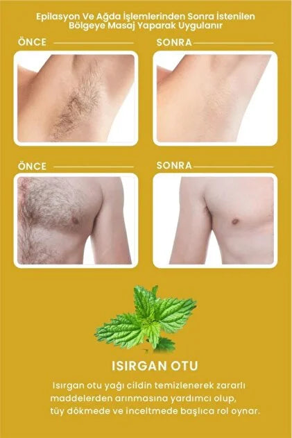 LES VHES Post Depilatory Milk 100 ml | Tüy İnceltici ve Nemlendirici Bakım Sütü | Epilasyon Sonrası Bakım