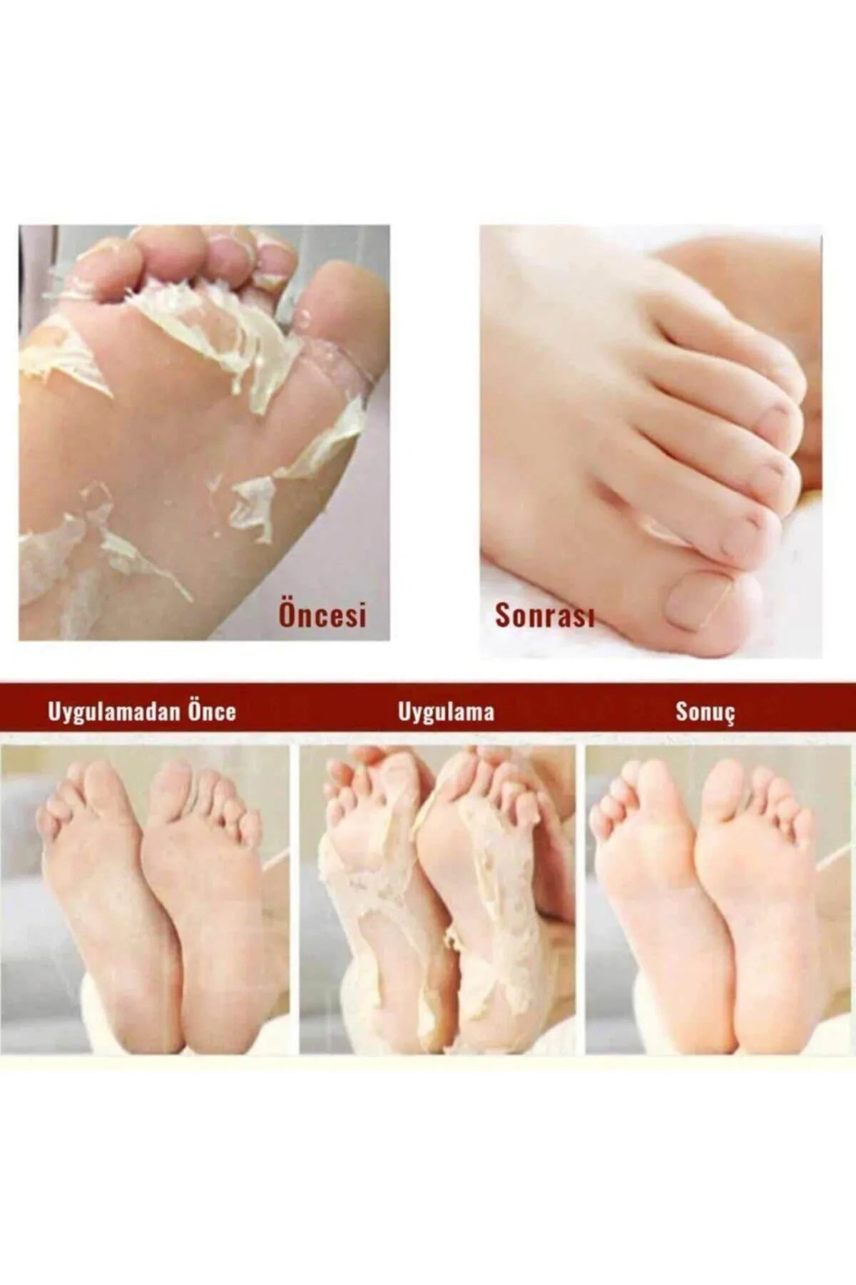 Mjcare Miracle Foot Peeling Pack - Mjcare Soktype Voetpeelingmasker 2 stuks sokken van 15 ml