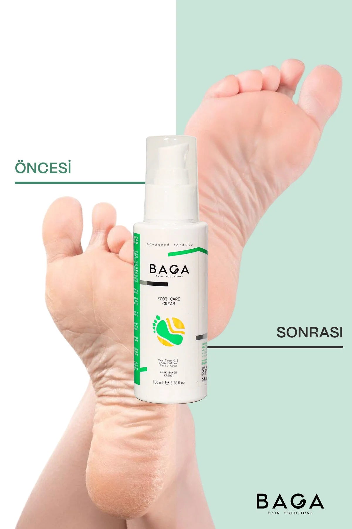 BAGA Foot Care Cream 100ml