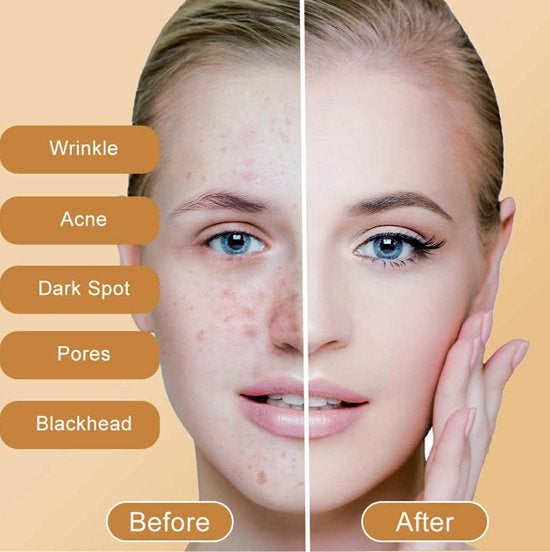 Kojic Acid Soap for Hyperpigmentation - Natuurlijke Huid Whitening Zeep voor diepe gezichts- en lichaamshuidreiniging - Collageen - Vitamine E - Honing - Citroen - Kurkuma - Shea Boter & Olijfolie - Vitamine C - 100% Biologisch (2 stuks)