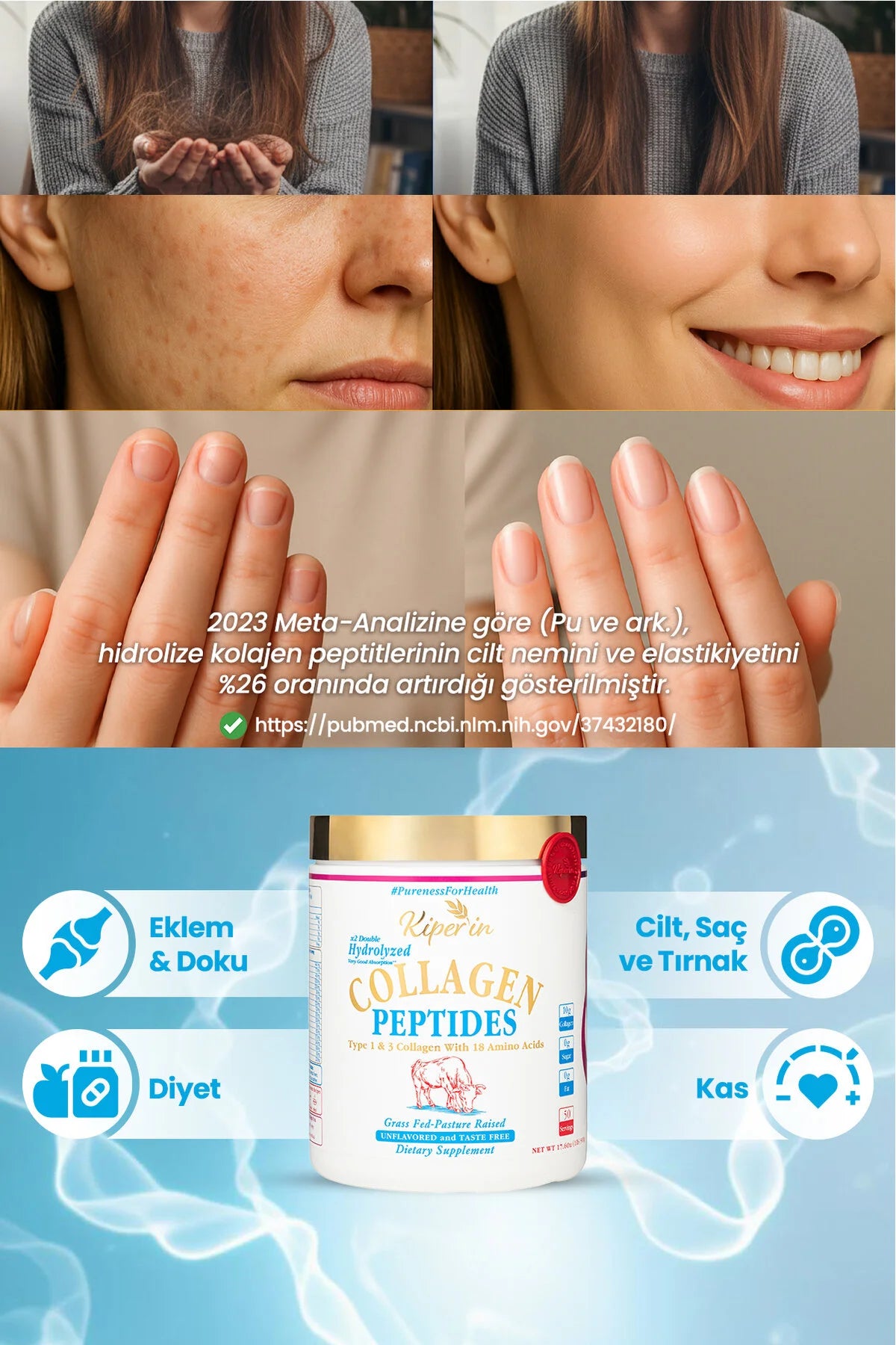 Kiperin Collagen Peptides-500gr