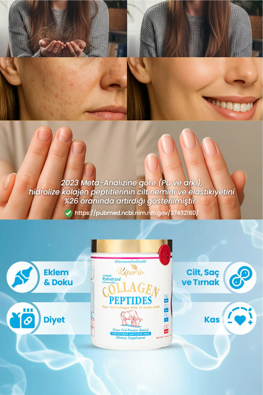 Kiperin Collagen Peptides-500gr