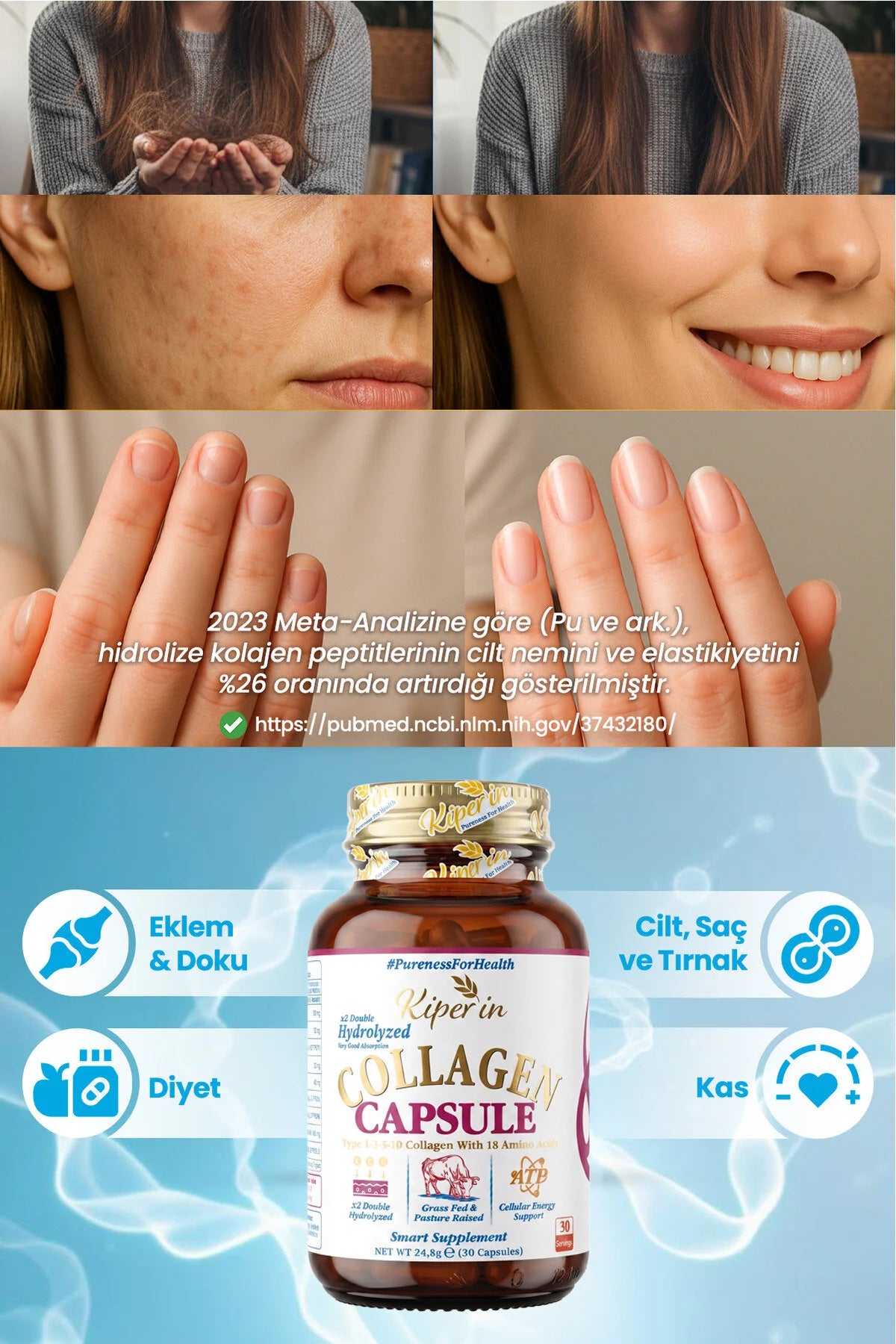 Kiperin Collagen Capsule Type 1-3-10 30 Capsules