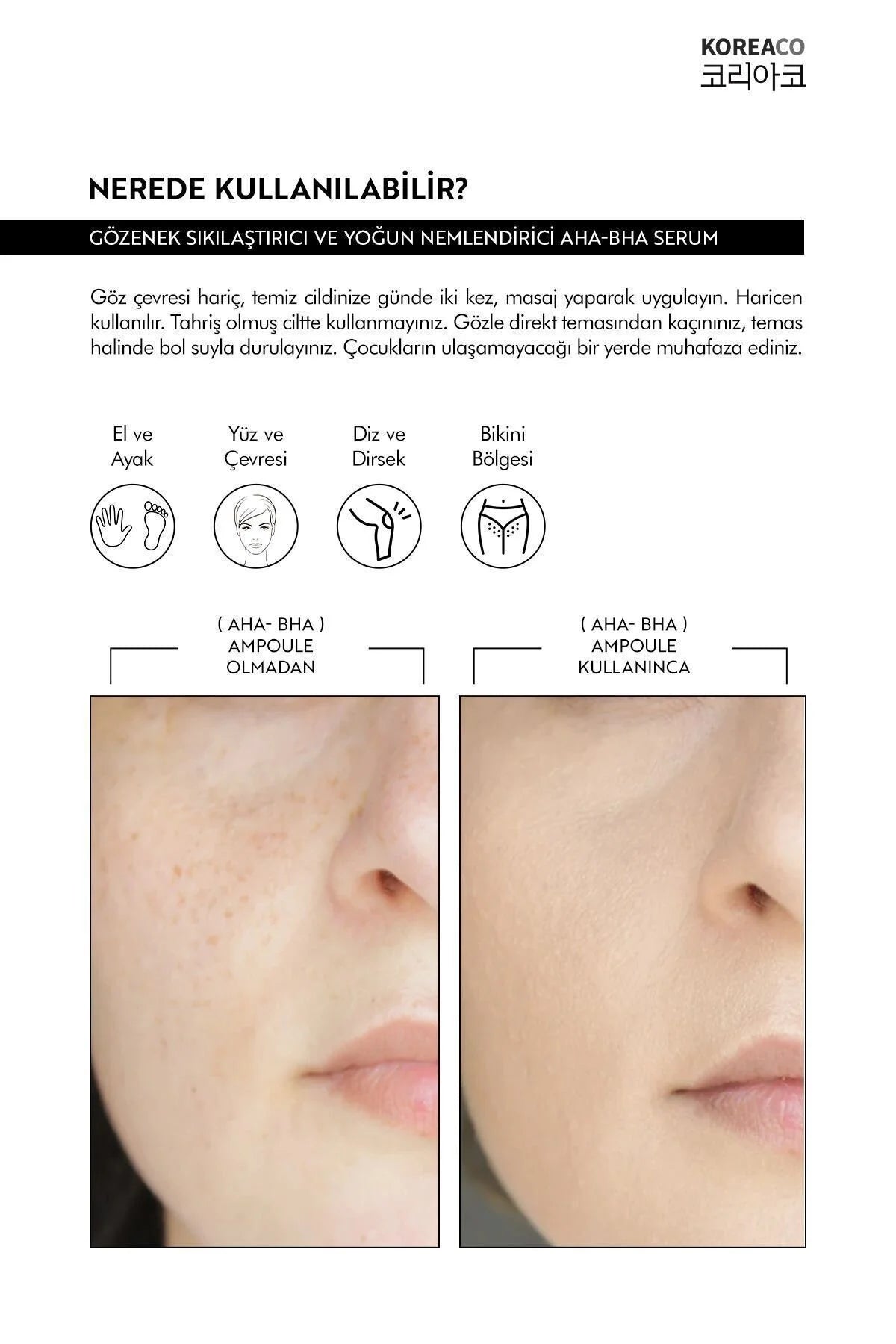 Koreaco - Pore Tightening And Moisturizing Ampoule | AHA & BHA Revitaliserende & Poriënverstrakking & Hydratatie | VEGAN | 50 (ml.) |