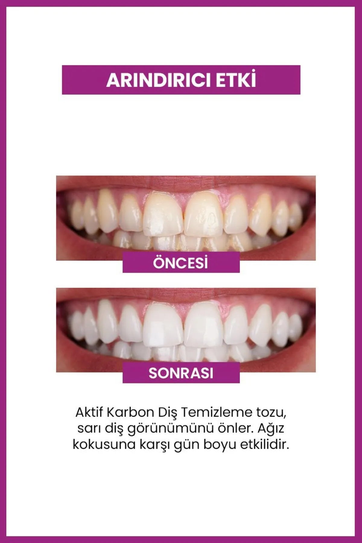 Luis Bien - Geactiveerde Koolstof Tandenbleekpoeder - Tegen sigaretten- thee- en koffievlekken - Zuiverend & Witmakend Effect - Natuurlijke formule - 50 gram