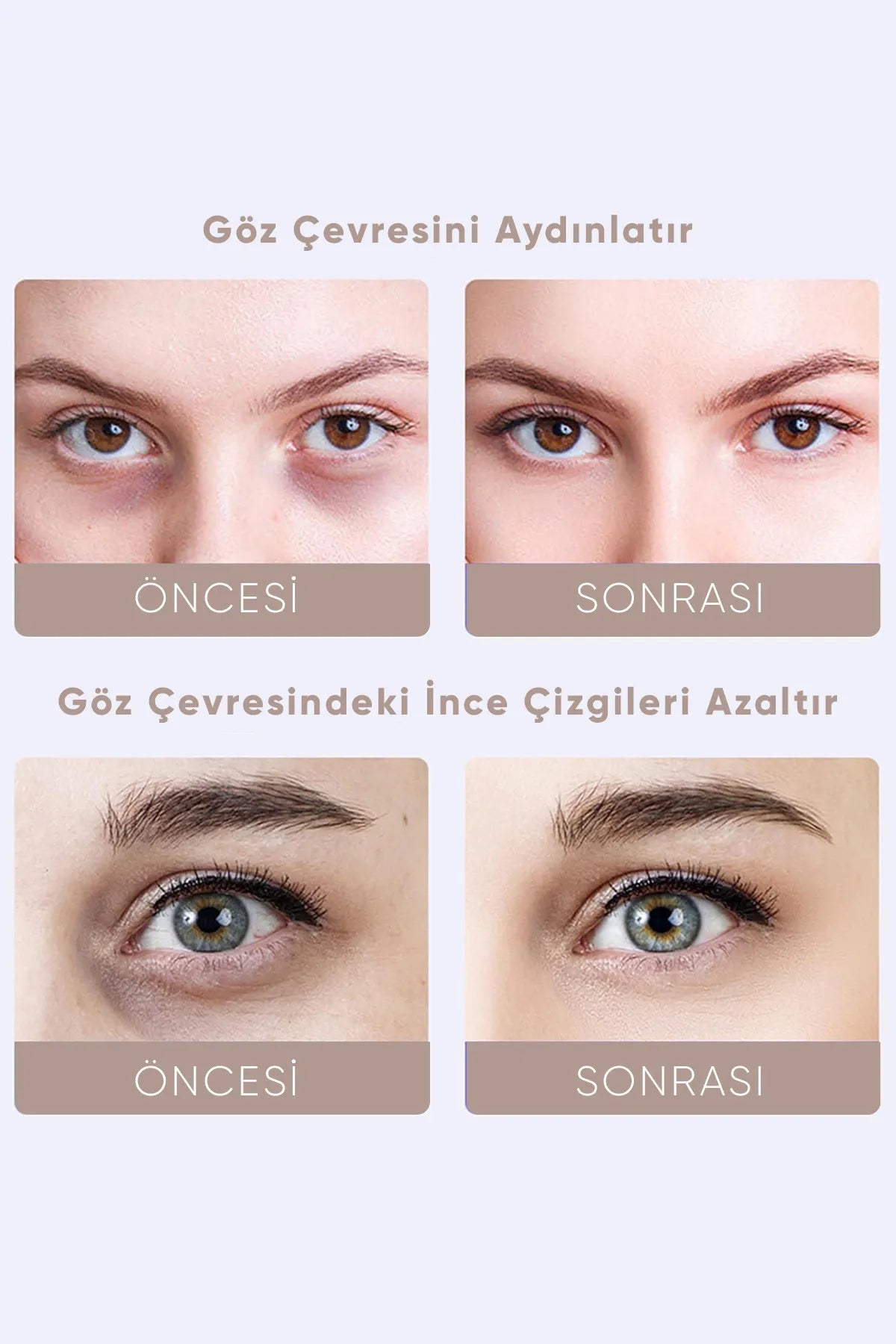 Kloee - Age Defying Intense Eye Contour Cream - Oogcontourcreme tegen Veroudering - Elektrische massage oogcreme - Anti-aging en anti-rimpel vibrerende elektrische massagecrème voor donkere kringen en donkere kringen onder de ogen (20 ml)