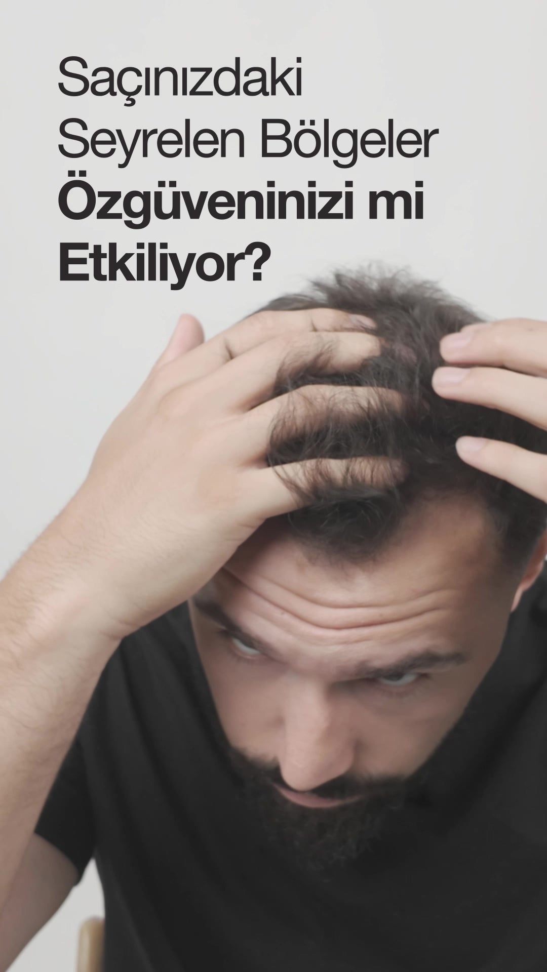 Luis Bien Hair Thickener Spray Black - Haardikkingsspray voor Dun Haar - Volumizing Hair Spray Black - Concealer voor dun haar & direct een volle look - Natuurlijk vol effect in 30 Seconden - Waterbestendig & Langdurig - Dermatologisch getest -100 ml