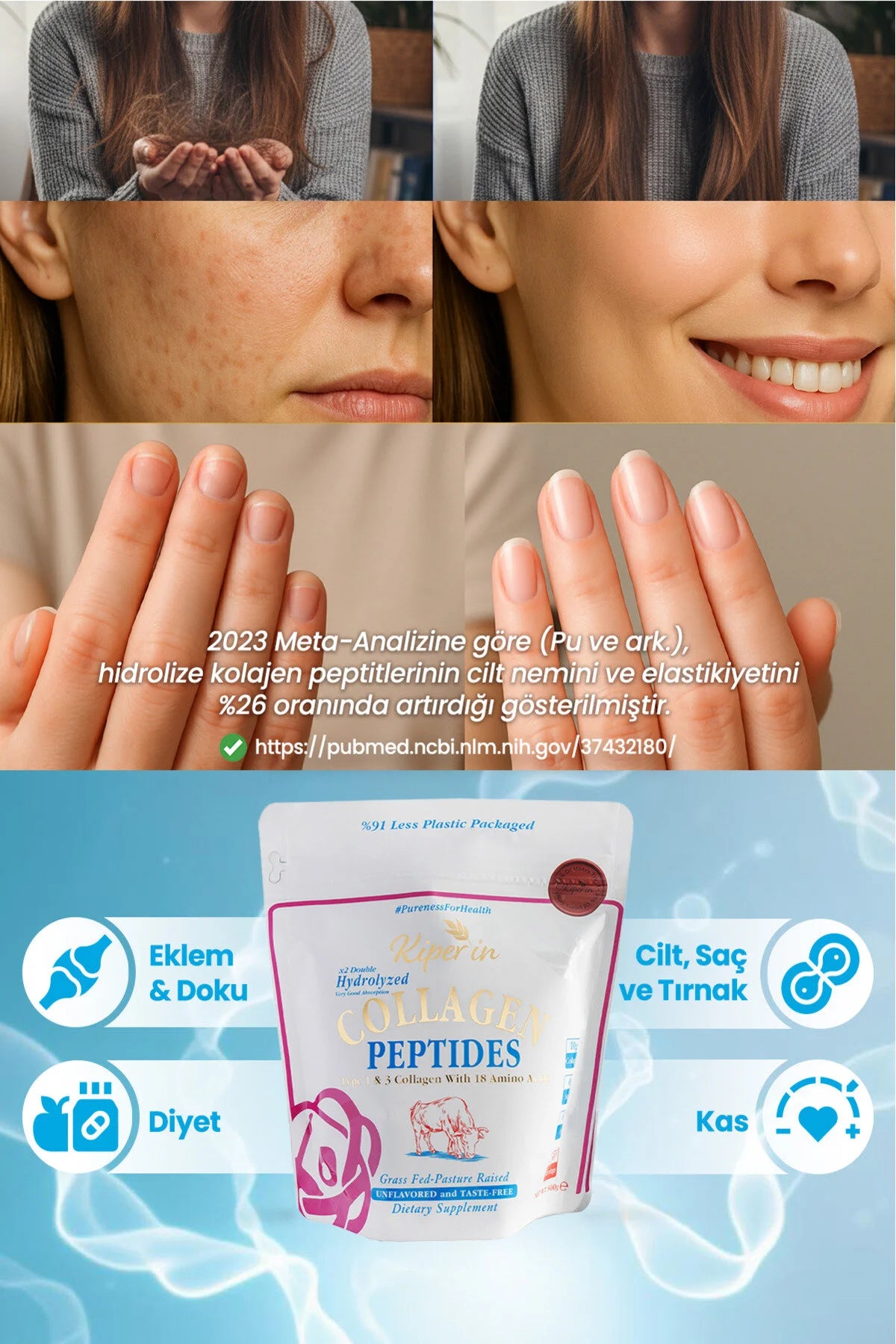 Kiperin Collagen Peptides – Gehydrolyseerd Rundercollageen Type 1 & 3 – 10 g Collageenpeptiden per Portie – Naturel – 300 g