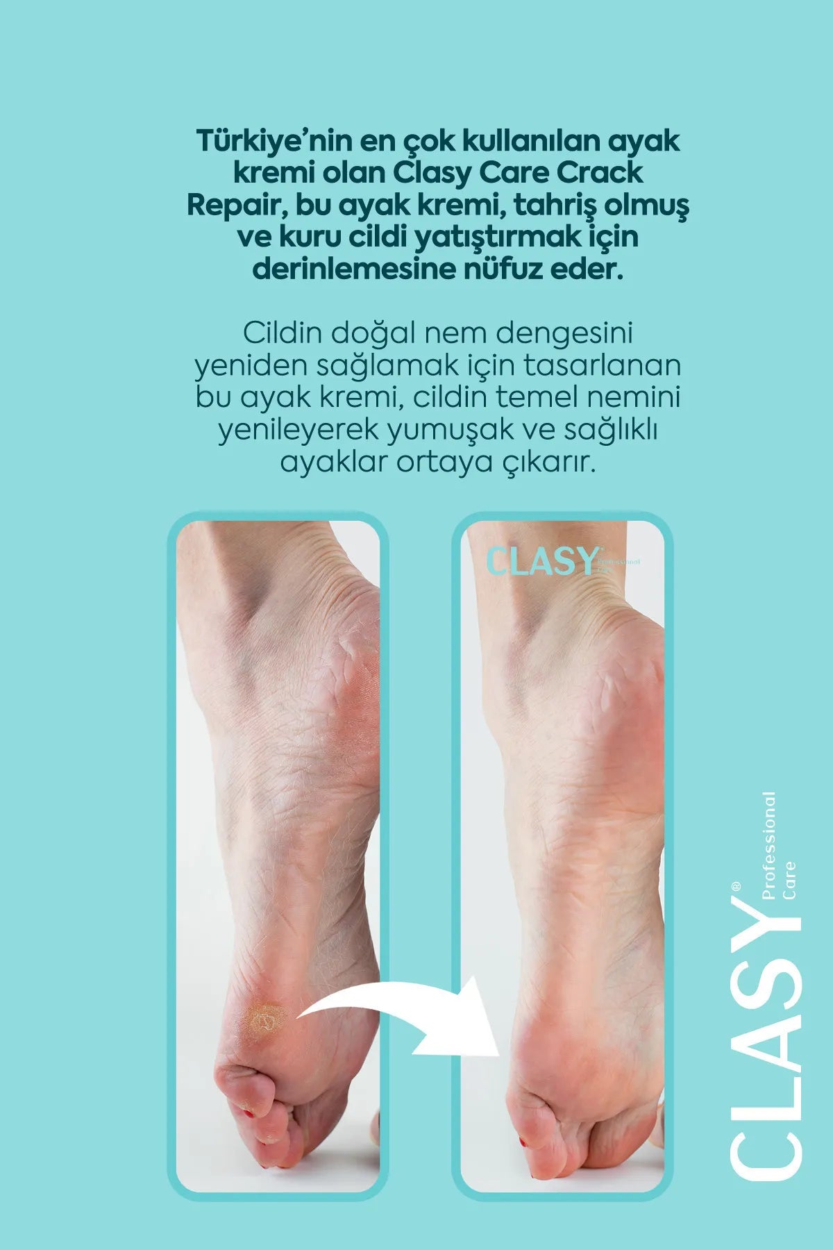 CLASY CARE Professionele Voetverzorgings- en reparatie Crème voor het Herstellen van Barsten voor droge Gebarsten en versleten hakken Vitamine E + Avocado-Olie Voor alle huidtypes 100 ml