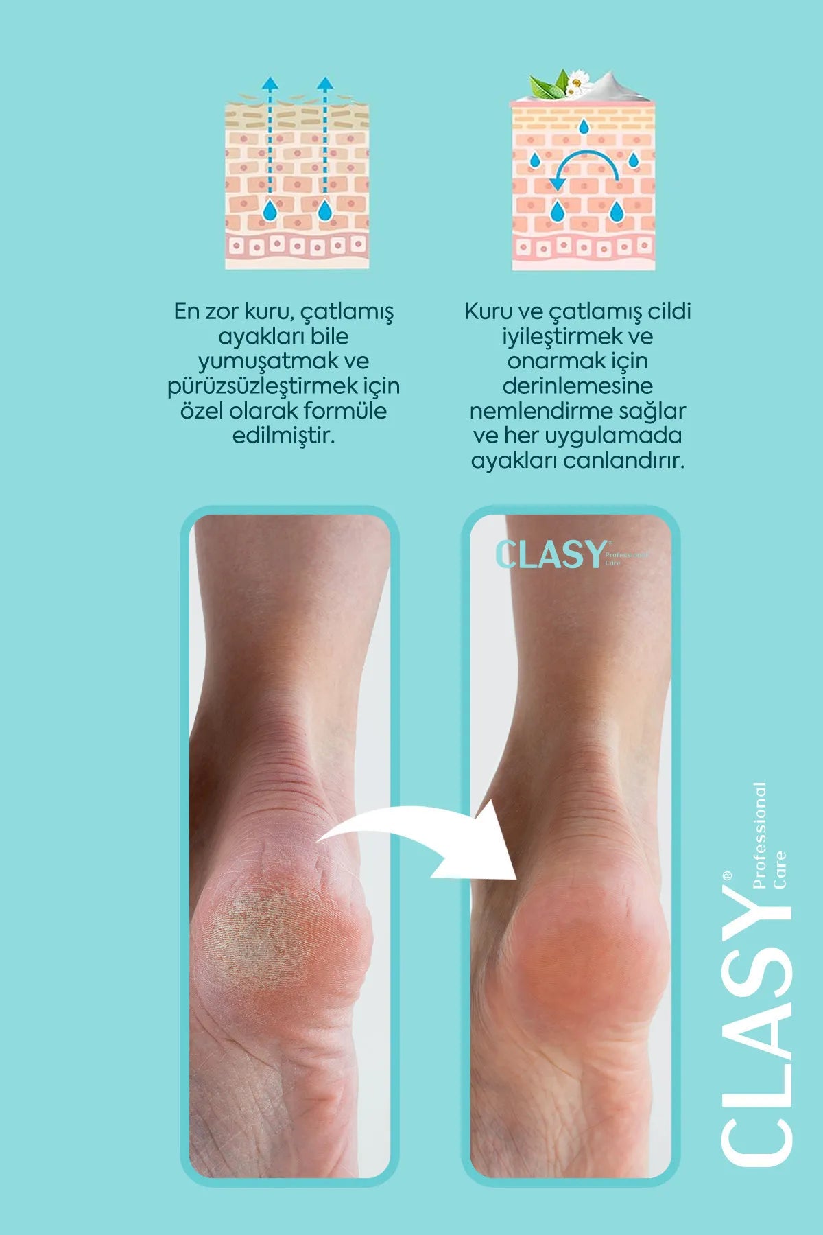 CLASY CARE Professionele Voetverzorgings- en reparatie Crème voor het Herstellen van Barsten voor droge Gebarsten en versleten hakken Vitamine E + Avocado-Olie Voor alle huidtypes 100 ml