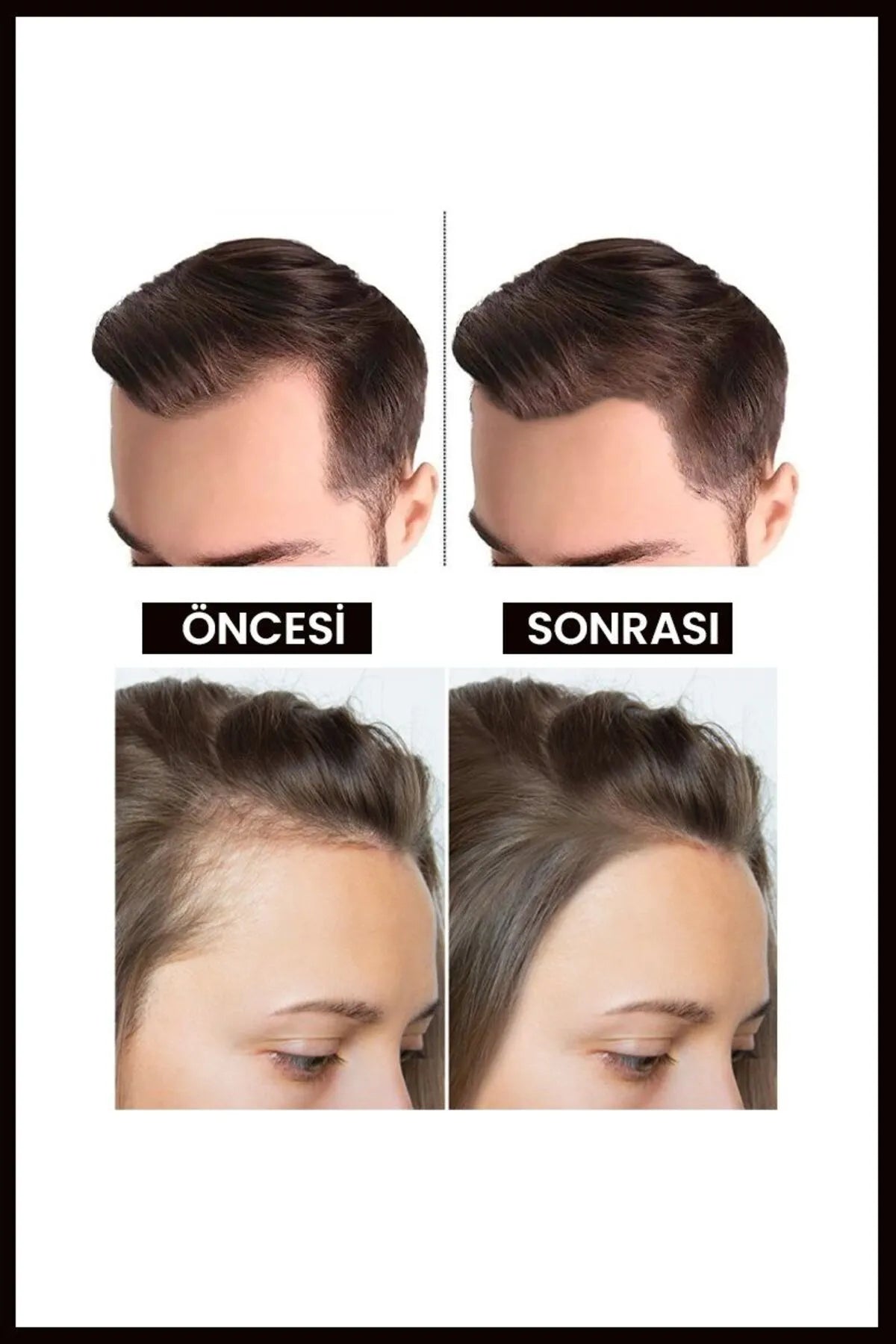 Luis Bien Zwarte Knoflookolie - Verzorging voor extreem beschadigd en uitvallend haar - Voedende en herstellende olie - Helpt om vol en volumineus haar krijgen - Dermatologisch getest - 50 ml