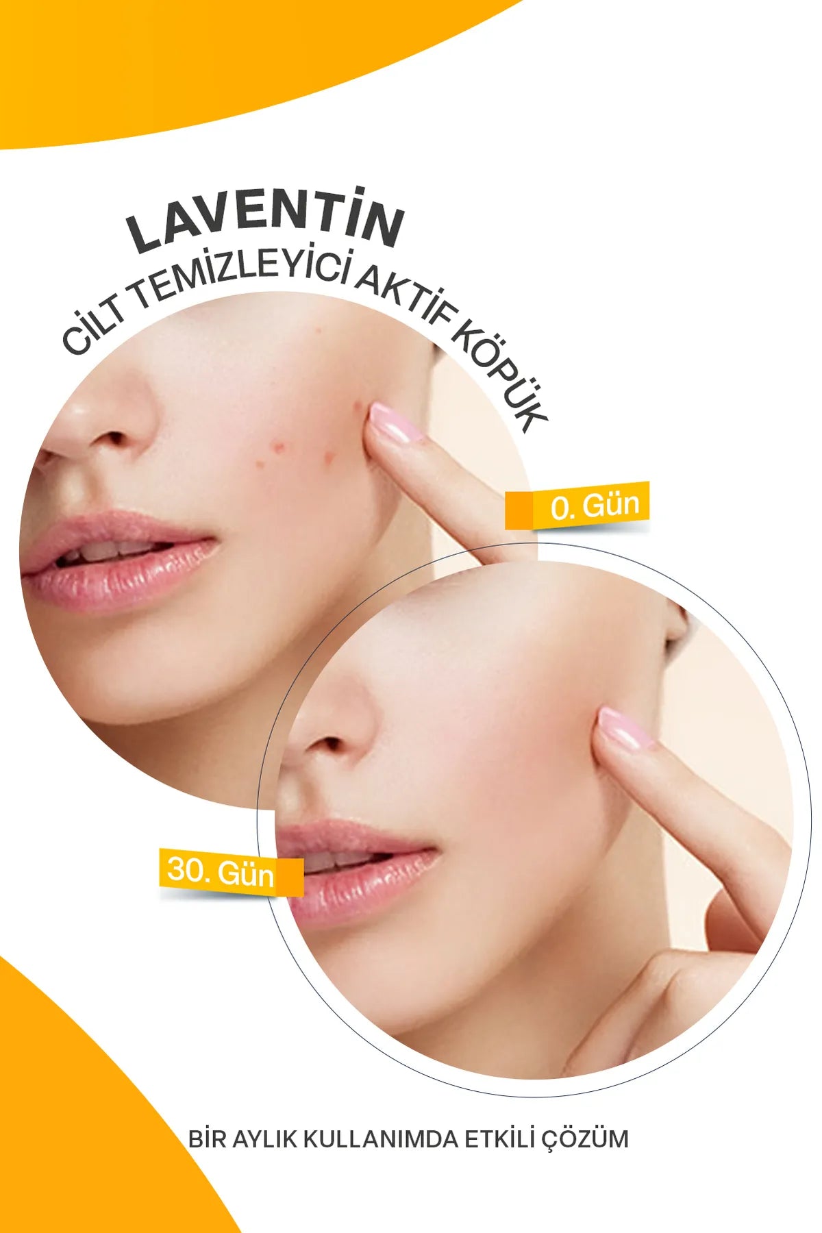 Laventin Professionele Face Cleanser - Gezichtsreiniger - Intensive Purifying Cleansing Active Form - Salicylic & Glycolic Acid - Acne-Prone Skin - Alle huidtypen ook de gevoelige huid - Vegan - Superieure bescherming - Verfrissend effect - 200 ml