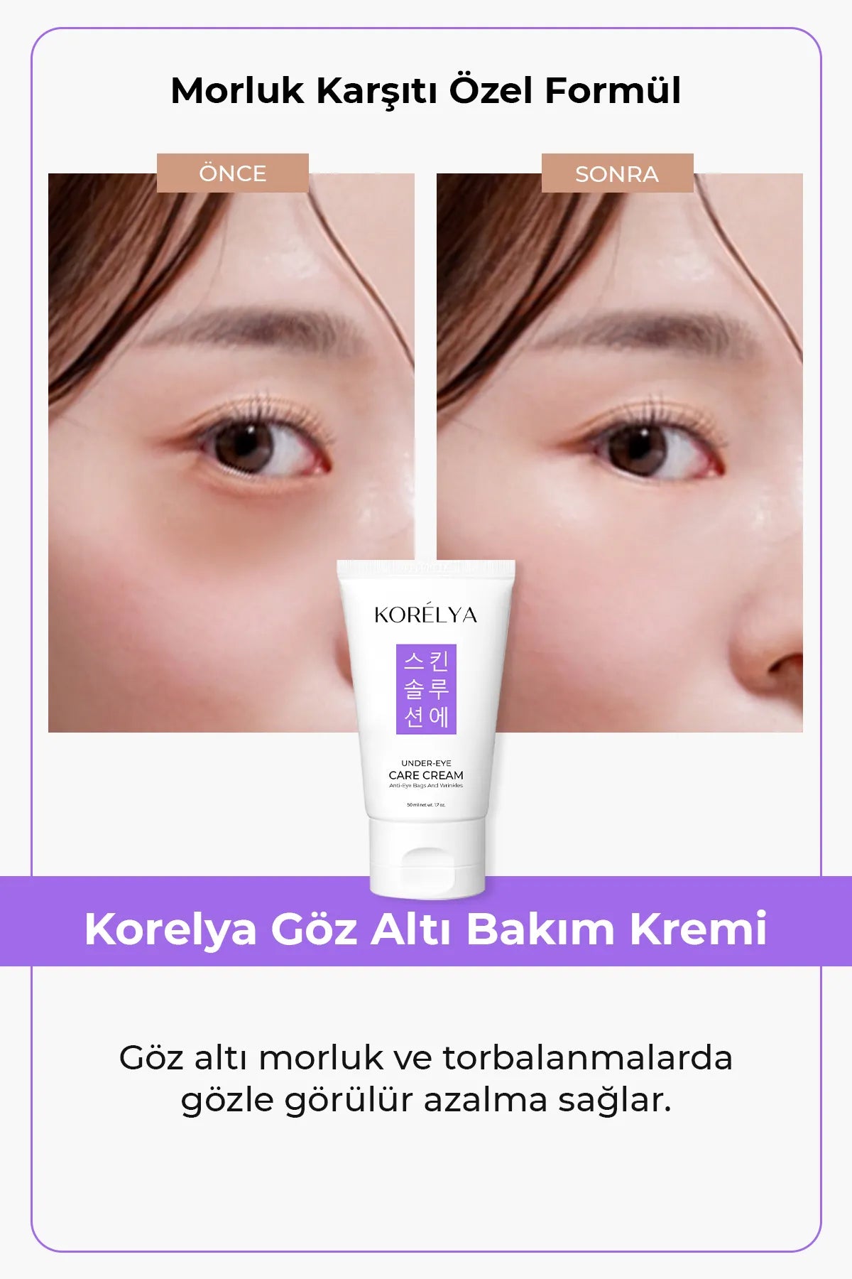 KORELYA Under Eye Care Cream Anti-Eye Bags & Wrinkles - Voedt de huid onder de ogen - Bestrijdt Wallen - Rimpels - Fijne lijntjes - Donkere kringen - Wallen & Blauwe Plekken - Caffeïne - Panthenol - Hyaluronzuur - Vitamine C - Alle huidtypen - 50ml