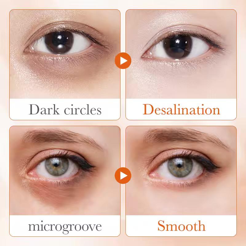 SADOER Skin Active 5x Vitamin C Eye Cream - 5 in 1 Active Vitamine C + Niacinamide - Verstevigend & Voedend Oogcreme - Vermindert donkere kringen - Verstevigt de oogcontext - Multi-effect herstel - Alle huidtypen - 20 gr