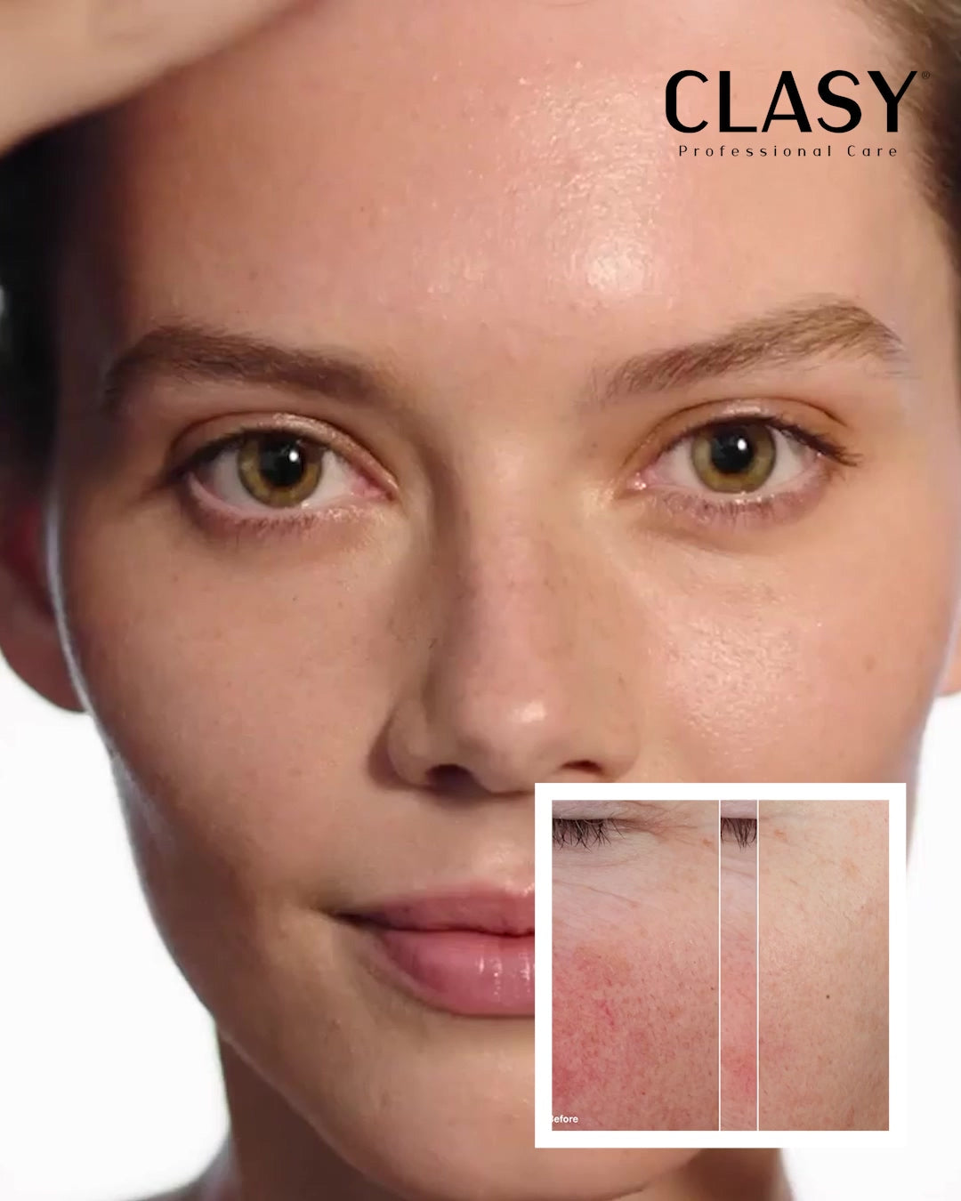 Clasy Care- face up skin - brightening cream - pigmentvlekken creme - BESTE PIGMENT CREME