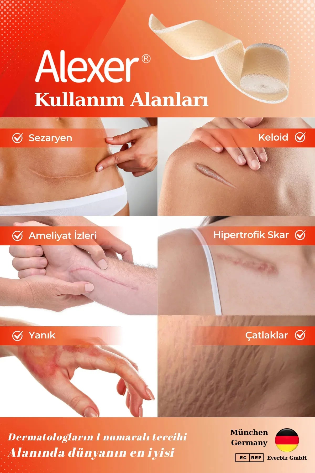 Alexer Silicone Tape Scar Removal - Zachte siliconen tape - Verwijderen van littekens - brandwonden - keizersnede-incisielijn - keloïden - chirurgische littekens - esthetische operaties - rimpels - door Dermatologen aanbevolen - 2,5 cm x 3 m / 1 rol