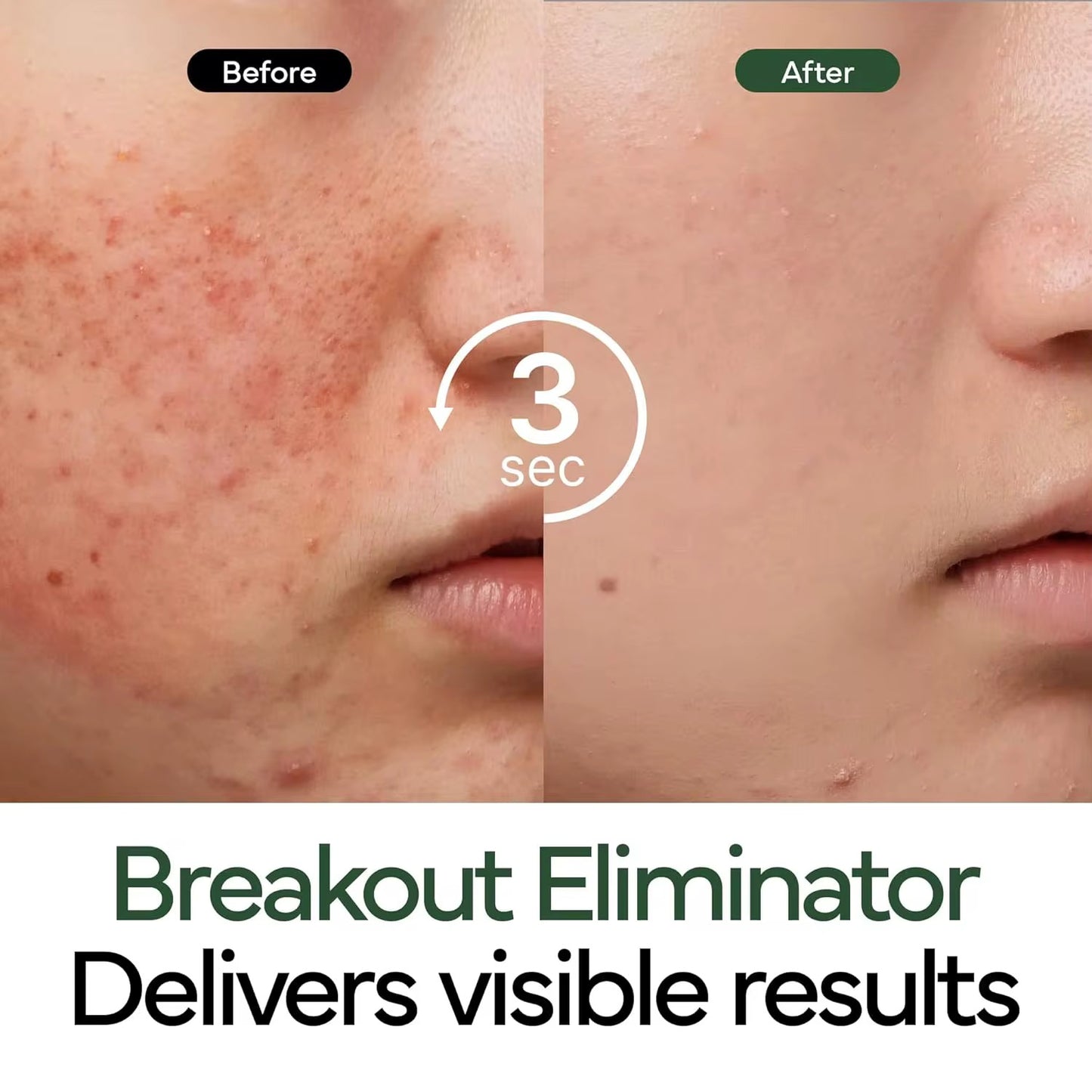 Ivoskin Intensive Cica Repair Cream Ultra-Moisturizing Care for Sensitive Skin with Centella Asiatica Madecassoside Panthenol Ceramides Hyaluronic Acid - Herstellende Creme - Ultra-Hydraterende verzorging voor gevoelige huid - Diepe hydratatie - 50gr