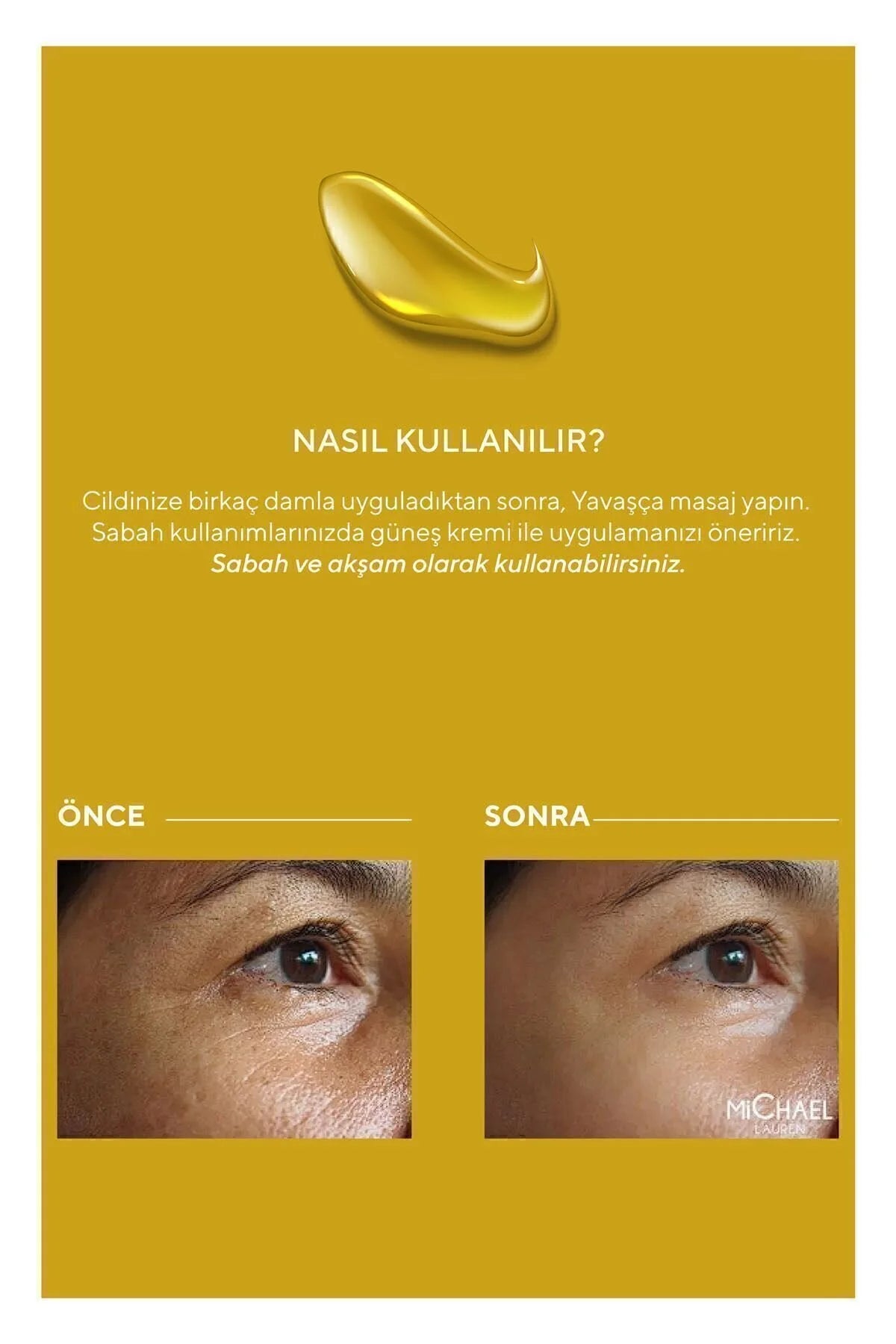 MiChael Lauren Serum Anti-vlekken Chlorella Algenextract 20% Vitamine C Serum Plus + Ferulic Acid + Hyaluronic Acid (Chlorella vulgaris) Verzacht Hydrateert Vermindert lijntjes en rimpels Corrigeert ruwe huid geneest Acnevlekken en Littekens 30 ml